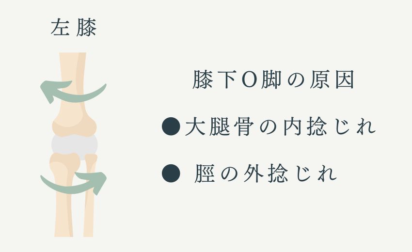 膝下O脚の原因：大腿骨の内捻じれ・脛の外捻じれ
